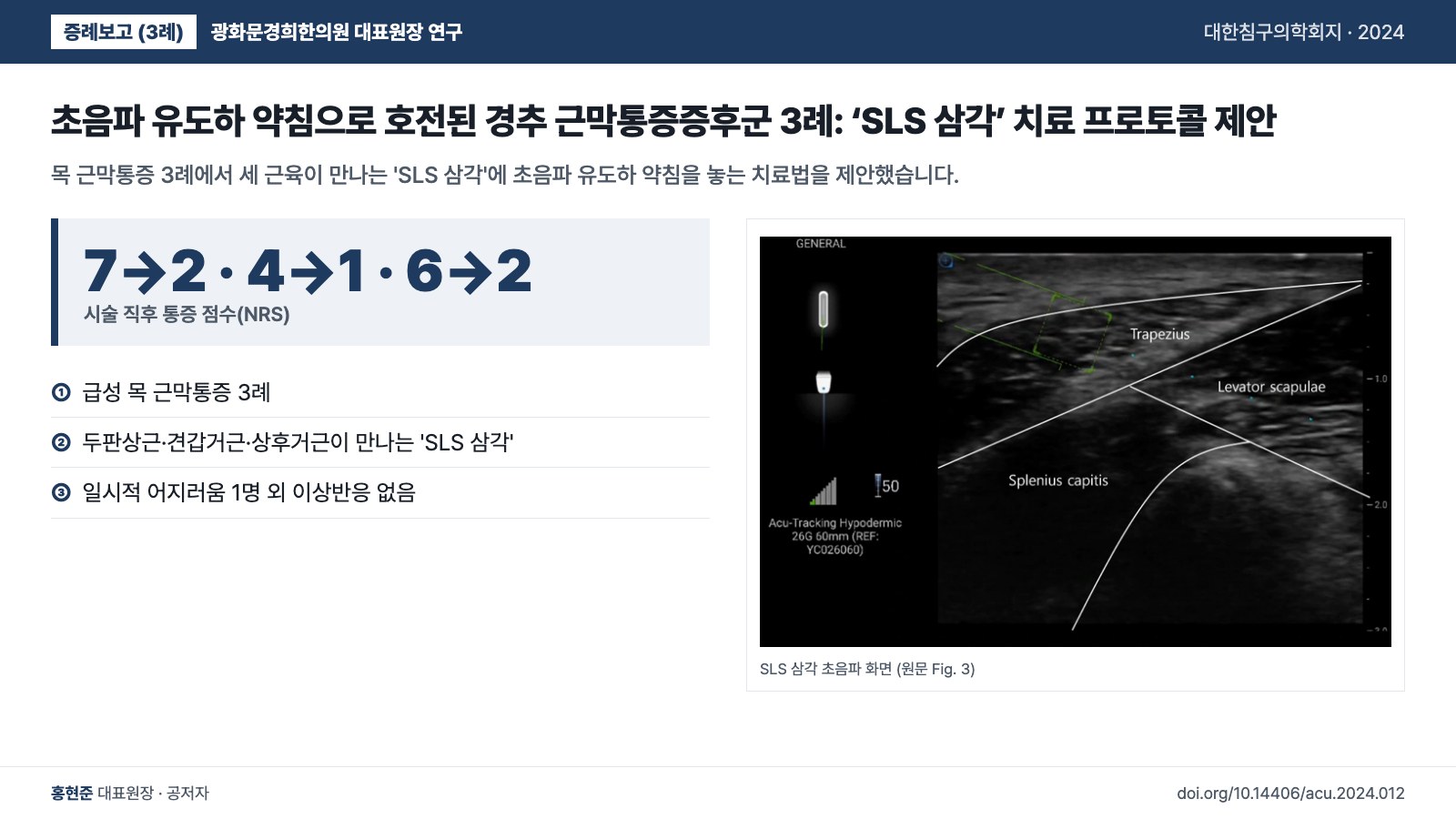 초음파 유도하 약침으로 호전된 경추 근막통증증후군 3례: ‘SLS 삼각’ 치료 프로토콜 제안 — 목 근막통증 3례에서 세 근육이 만나는 'SLS 삼각'에 초음파 유도하 약침을 놓는 치료법을 제안했습니다.